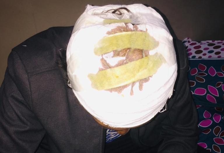 Unidentified persons tortured the laborer with sticks and rods